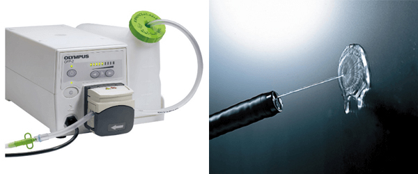 ジェット送水機を用いることによって、スコープ先端からのジェット送水が可能となります。