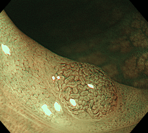 さらに拡大機能を併用することで詳細に観察することができます。