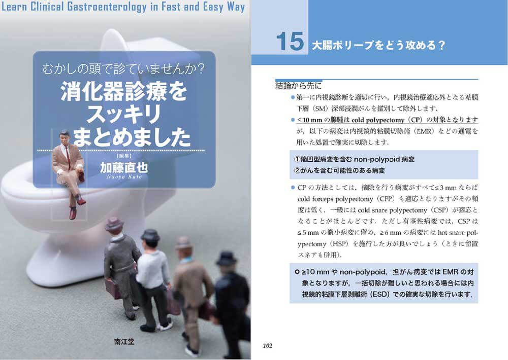 消化器内科・一般内科診療の先生方へ向けた大腸ポリープ治療法の解説