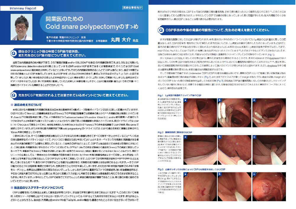 開業の内視鏡医の先生方へ向けた現在の主流の内視鏡治療法の解説