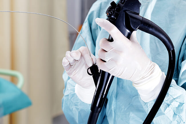 大腸内視鏡検査では大腸がんの発見のほか、早期がんやがんの原因となる腺腫などの切除が可能