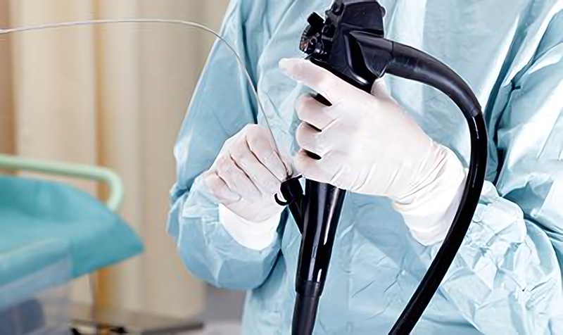 内視鏡検査の様子