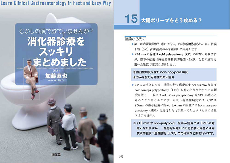 消化器内科・一般内科診療の先生方へ向けた大腸ポリープ治療法の解説