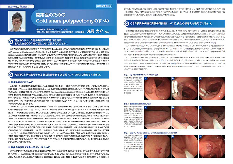 開業の内視鏡医の先生方へ向けた現在の主流の内視鏡治療法の解説
