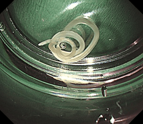 アニサキス虫体