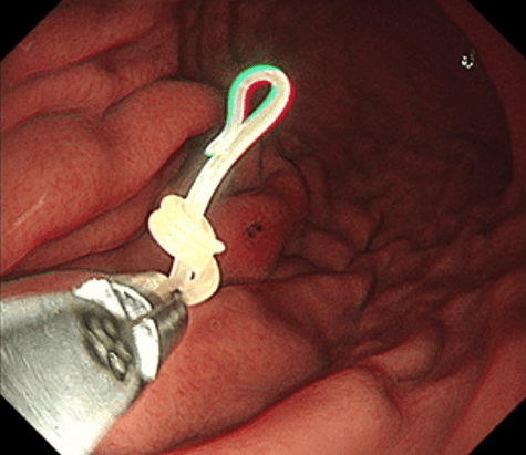 よく動くアニサキス